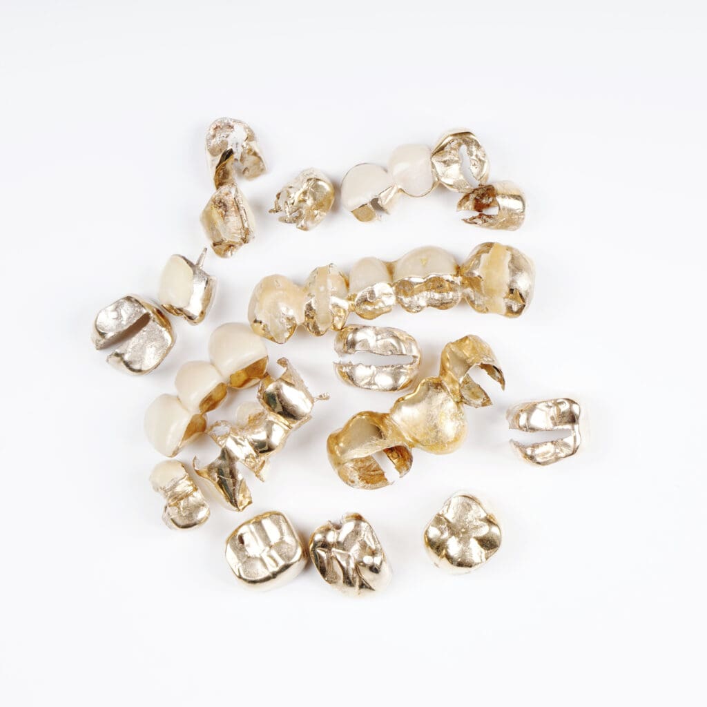 gold prices dental scrap