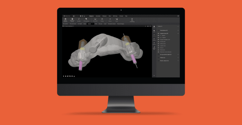 Dexis Digital Imaging Technology